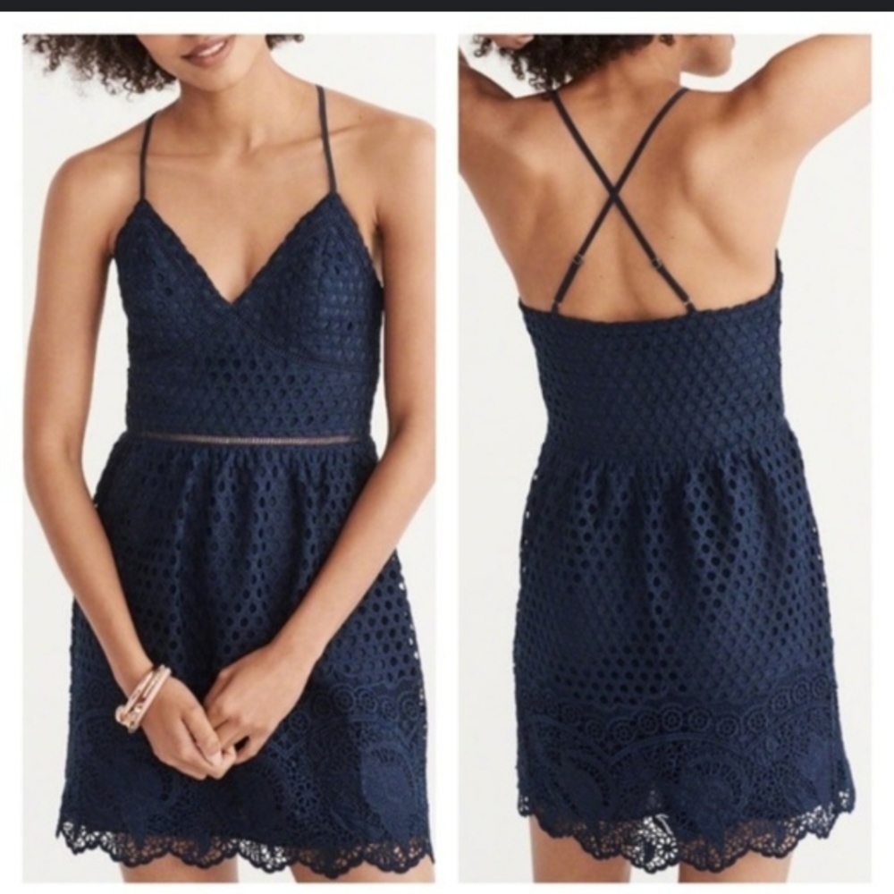 Abercrombie & Fitch Lace & overlay dress
